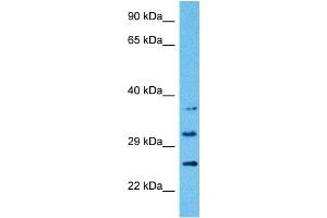 Western Blotting (WB) image for anti-ATPase, Na+/K+ Transporting, beta 1 Polypeptide (ATP1B1) (Middle Region) antibody (ABIN2781852)