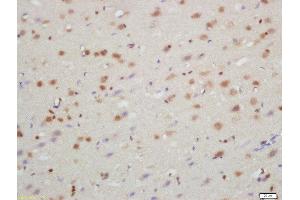 Formalin-fixed and paraffin embedded rat brain labeled with Rabbit Anti-TXNIP Polyclonal Antibody, Unconjugated  at 1:200 followed by conjugation to the secondary antibody and DAB staining (TXNIP 抗体  (AA 101-200))