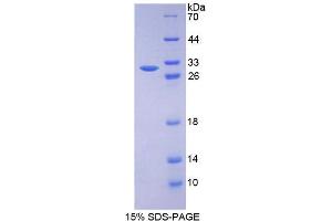 Image no. 1 for RAD50 Homolog (S. Cerevisiae) (RAD50) (AA 1-234) protein (His tag) (ABIN6237280) (RAD50 Protein (AA 1-234) (His tag))