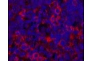 Immunofluorescence analysis of Rat spleen tissue using ERBB2 Monoclonal Antibody at dilution of 1:200. (ErbB2/Her2 抗体)