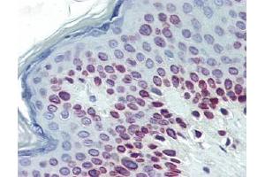 IHC Image for AP22639PU-N Human Skin (formalin-fixed, paraffin-embedded) stained with Lamin Cat 1/50 followed by biotinylated goat anti-rabbit IgG secondary antibody LS-D1, alkaline phosphatase-streptavidin and chromogen. (Lamin A/C 抗体  (N-Term))