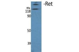 Western Blotting (WB) image for anti-Ret Proto-Oncogene (RET) (Thr77) antibody (ABIN3180294) (Ret Proto-Oncogene 抗体  (Thr77))