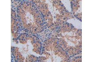 Used in DAB staining on fromalin fixed paraffin- embedded Kidney tissue (CANT1 抗体  (AA 111-403))