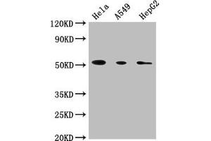 Western Blot Positive WB detected in: Hela whole cell lysate, A549 whole cell lysate, HepG2 whole cell lysate All lanes: CD14 antibody at 1:1800 Secondary Goat polyclonal to Mouse IgG at 1/10000 dilution Predicted band size: 41 kDa Observed band size: 55 kDa (CD14 抗体  (AA 20-345))