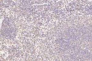 Immunohistochemistry (Paraffin-embedded Sections) (IHC (p)) image for anti-Acidic (Leucine-Rich) Nuclear phosphoprotein 32 Family, Member B (ANP32B) antibody (ABIN7072887)