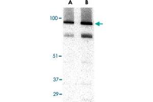 Western blot analysis of TRPC3 in human brain tissue lysate with TRPC3 polyclonal antibody  at (A) 1 and (B) 2 ug/mL . (TRPC3 抗体  (C-Term))
