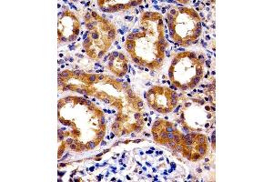 Immunohistochemical analysis of paraffin-embedded H. (SPHK1 抗体  (N-Term))