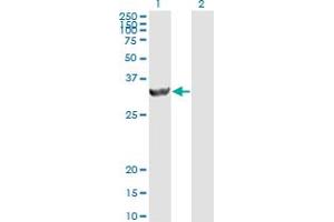 Western Blotting (WB) image for anti-Proteasome (Prosome, Macropain) Activator Subunit 2 (PA28 Beta) (PSME2) (AA 1-90) antibody (ABIN562499)