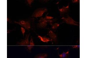 Immunofluorescence analysis of C6 cells using TYMS Polyclonal Antibody at dilution of 1:100. (TYMS 抗体)