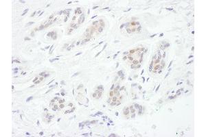Immunohistochemistry (IHC) image for anti-Forkhead Box C1 (FOXC1) (AA 275-325) antibody (ABIN7454490)