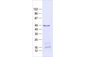 Validation with Western Blot (PLAGL1 Protein (His tag))