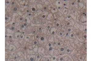 Immunohistochemistry (IHC) image for anti-Glycyl-tRNA Synthetase (GARS) (AA 567-735) antibody (ABIN7435301)