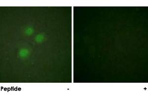 Immunofluorescence analysis of HUVEC cells, using MKI67IP polyclonal antibody . (NIFK 抗体)