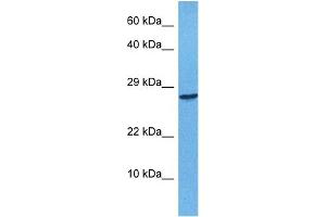 Host:  Rabbit  Target Name:  APOBEC3F  Sample Tissue:  Human 293T Whole Cell  Antibody Dilution:  1ug/ml (APOBEC3F 抗体  (N-Term))