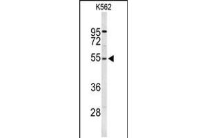 Western blot analysis of RPS6KB2 Antibody in K562 cell line lysates (35ug/lane) (RPS6KB2 抗体)