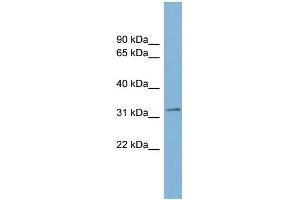 WB Suggested Anti-TMEM163 Antibody Titration:  0. (TMEM163 抗体  (Middle Region))