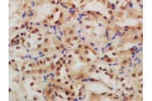Formalin-fixed and paraffin embedded rat kidney labeled with Rabbit Anti-GLIS3 Polyclonal Antibody, Unconjugated (ABIN2174444) at 1:200 followed by conjugation to the secondary antibody and DAB staining (GLIS3 抗体  (AA 101-200))