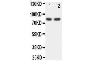 Anti-FOXP1 antibody, Western blotting Lane 1: Rat Spleen Tissue Lysate Lane 2: COLO320 Cell Lysate (FOXP1 抗体  (C-Term))