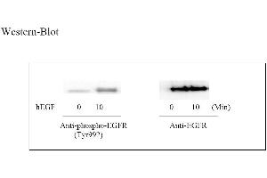 Image no. 4 for Epidermal Growth Factor Receptor (EGFR) ELISA Kit (ABIN625225)