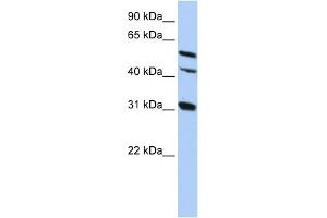WB Suggested Anti-GJA8 Antibody Titration:  0.