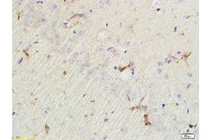 Formalin-fixed and paraffin embedded rat brain labeled with Rabbit Anti EphA7/Eph receptor A7 Polyclonal Antibody, Unconjugated  at 1:200 followed by conjugation to the secondary antibody and DAB staining (EPH Receptor A7 抗体  (AA 181-280))