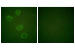 Immunofluorescence analysis of HuvEc cells, using Tyrosine Hydroxylase (Phospho-Ser19) antibody. (Tyrosine Hydroxylase 抗体  (pSer19))
