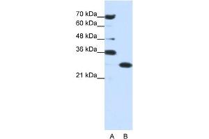 WB Suggested Anti-ANP32A Antibody Titration:  0. (PHAP1 抗体  (Middle Region))