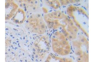 DAB staining on IHC-P; Samples: Human Kidney Tissue (RNF112 抗体  (AA 73-322))