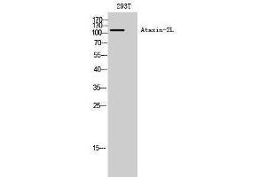 Western Blotting (WB) image for anti-Ataxin 2-Like (ATXN2L) (Internal Region) antibody (ABIN3180503) (Ataxin 2-Like 抗体  (Internal Region))