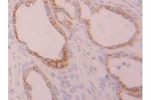 IHC-P analysis of Rat Ovary Tissue, with DAB staining. (Cytokeratin 7 抗体  (AA 255-393))