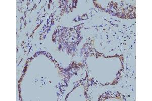 IHC analysis of Cyclophilin E/PPIE using anti-Cyclophilin E/PPIE antibody (ABIN7599243). (PPIE 抗体  (AA 1-301))