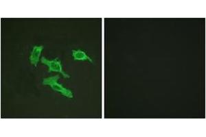 Immunofluorescence analysis of HepG2 cells, using EGFR (Ab-1016) Antibody. (EGFR 抗体  (AA 986-1035))