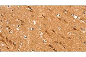 Immunohistochemistry (Paraffin-embedded Sections) (IHC (p)) image for anti-Solute Carrier Family 25 (Mitochondrial Carrier, Aralar), Member 12 (Slc25a12) antibody (ABIN7239458)
