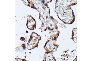 Immunohistochemistry (IHC) image for anti-Male Germ Cell-Associated Kinase (MAK) (AA 370-435) antibody (ABIN7268382)
