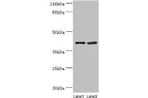 Western blot All lanes: NUDCD3 antibody at 5 μg/mL Lane 1: 293T whole cell lysate Lane 2: Hela whole cell lysate Secondary Goat polyclonal to rabbit IgG at 1/10000 dilution Predicted band size: 41 kDa Observed band size: 41 kDa (NUDCD3 抗体  (AA 142-361))