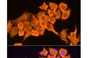 Immunofluorescence analysis of HeLa cells using RPL23 Polyclonal Antibody at dilution of 1:100. (RPL23 抗体)
