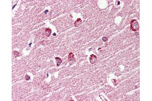 Anti-GPR119 antibody IHC of human brain, cortex. (G Protein-Coupled Receptor 119 抗体  (Cytoplasmic Domain))