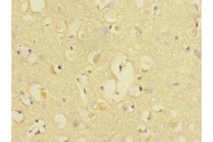 Immunohistochemistry of paraffin-embedded human brain tissue using ABIN7147143 at dilution of 1:100 (CD226 抗体  (AA 19-254))