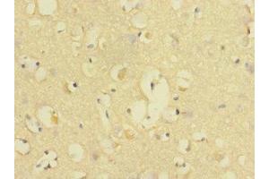 Immunohistochemistry of paraffin-embedded human brain tissue using ABIN7147143 at dilution of 1:100
