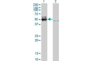 Western Blot analysis of EPSTI1 expression in transfected 293T cell line by EPSTI1 monoclonal antibody (M01), clone 2A8. (EPSTI1 抗体  (AA 1-100))