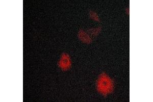 Immunofluorescence (fixed cells) (IF/ICC) image for anti-Met Proto-Oncogene (MET) (Internal Region) antibody (ABIN6260340)
