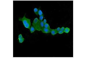 IF analysis of CLPX using anti-CLPX antibody (ABIN7601368).