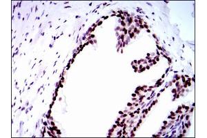 Image no. 5 for anti-Replication Protein A1, 70kDa (RPA1) antibody (ABIN1500741) (RPA1 抗体)