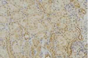 ABIN6279010 at 1/100 staining Mouse kidney tissue by IHC-P. (MRPS18B 抗体  (Internal Region))