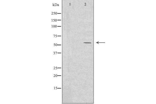 IKZF2 抗体  (Internal Region)
