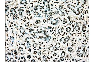 Image no. 6 for anti-TYRO3 Protein Tyrosine Kinase (TYRO3) antibody (ABIN1501608)