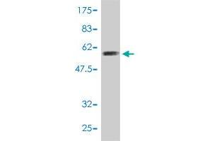 Western Blot detection against Immunogen (54. (PSMA4 抗体  (AA 1-261))