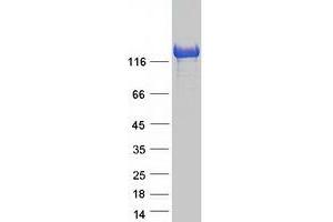 Western Blotting (WB) image for Elongator Complex Protein 1 (ELP1) protein (Myc-DYKDDDDK Tag) (ABIN2712281)
