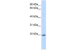 WB Suggested Anti-ZNF534 Antibody Titration:  0.