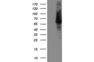 Western Blotting (WB) image for anti-IlvB (Bacterial Acetolactate Synthase)-Like (ILVBL) antibody (ABIN1498879) (ILVBL 抗体)
